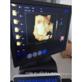 3D 4D USG Full digital 4D Ultrasound Price Trolley 4D Ultrasound Machine